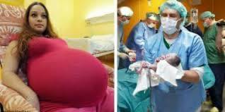 23 წლის დედამ გააჩინა ჩვილები, რომლებიც 480 წელიწადში ერთხელ იბადებიან