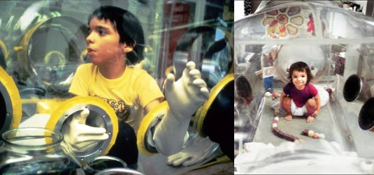 უნიკალური ისტორია – რატომ ცხოვრობდა ბავშვი მთელი ცხოვრება ბუშტში და რატომ არ შეიძლებოდა მისი იქედან გასვლა