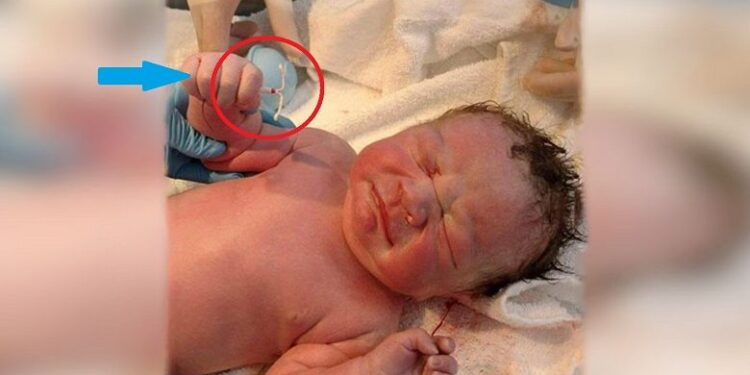 დედამ და ექიმებმა თვალებს არ დაუჯერეს, როცა ახალშობილის ხელში ეს მოწყობილობა დაინახეს