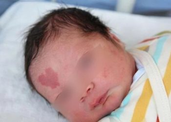 ვინ არის ბავშვი, რომელსაც შუბლზე დაბადებიდან გული აქვს გამოსახული