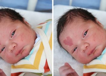 „ბავშვის ფოტოებმა მთელი ინტერნეტი წამში დაიპყრო..” – ნახეთ როგორ გამოიყურება ბიჭუნა, რომელიც გულის ფორმის ნიშნით დაიბადა (ფოტოები)