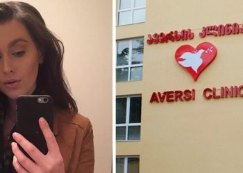 ”ცოტახანში თავის კანის წვა დამეწყო, სიმწრისგან ცრემლები მდიოდა, მამაჩემმა ეგრევე საავადმყოფოში გამაქანა, ექიმმა შემომხედა და თვალებს არ უჯერებდა…”