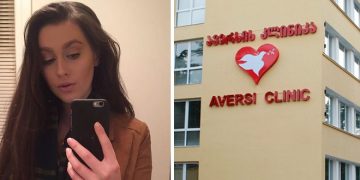 ”ცოტახანში თავის კანის წვა დამეწყო, სიმწრისგან ცრემლები მდიოდა, მამაჩემმა ეგრევე საავადმყოფოში გამაქანა, ექიმმა შემომხედა და თვალებს არ უჯერებდა…”