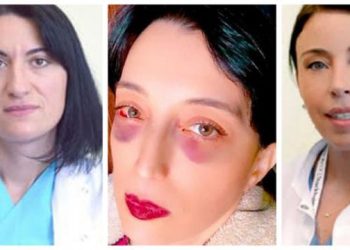 „შევამჩნიე, რომ თვალები უფრო და უფრო ხშირად მისივდებოდა, მხედველობა კი მკვეთრად მიუარესდებოდა.. პირველად მაშინ გავოცდი, როცა ანალიზები ავიღე და მითხრეს თანხა რომელიც უნდა გადამეხადა”