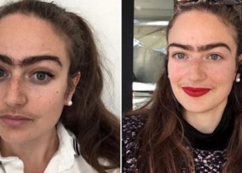 რატომ თქვა უარი ახალგაზრდა გოგომ ერთი წლის განმავლობაში სახის მოვლაზე და რა შედეგი მიიღო მან