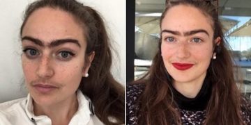 რატომ თქვა უარი ახალგაზრდა გოგომ ერთი წლის განმავლობაში სახის მოვლაზე და რა შედეგი მიიღო მან