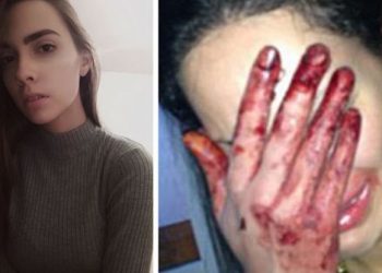 “15 წლისას სიყვარულს მიხსნიდა და ჩემს გამო ვენებს იჭრიდა… – მე სოფი ვარ და მინდა ჩემს შესახებ მოგიყვეთ”