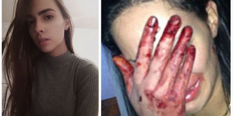 “15 წლისას სიყვარულს მიხსნიდა და ჩემს გამო ვენებს იჭრიდა… – მე სოფი ვარ და მინდა ჩემს შესახებ მოგიყვეთ”