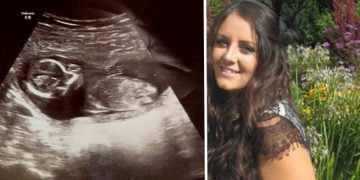 ქალს მუცელი მოეშალა, თუმცა 10 დღის შემდეგ ექიმებმა ბავშვის გულისცემა გაიგეს – წარმოუდგენელი სასწაული