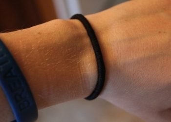 რა მიზეზით არის საშიში უბრალო თმის რეზინის ტარება – უბრალო ყოველდღიურმა ჩვევამ ლამის გოგონას სიცოცხლე იმსხვერპლა