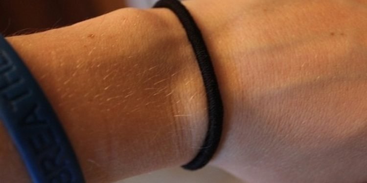 რა მიზეზით არის საშიში უბრალო თმის რეზინის ტარება – უბრალო ყოველდღიურმა ჩვევამ ლამის გოგონას სიცოცხლე იმსხვერპლა