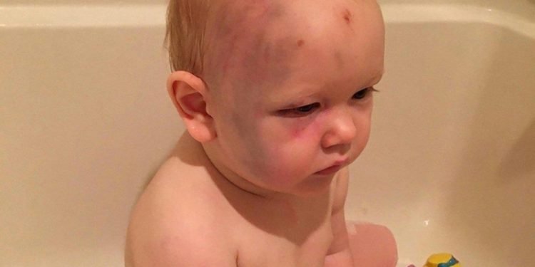 ძიძა, რომელმაც 1 წლის ბავშვი ცემა, სრულიად წარმოუდგენელი მიზეზით უდანაშაულოდ ცნეს