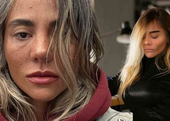 ჩემი დაავადების გამო თავი ხშირად დამიმცირებია და შემირცხვენია.. ეს ძალიან მძიმე დაავადებაა…