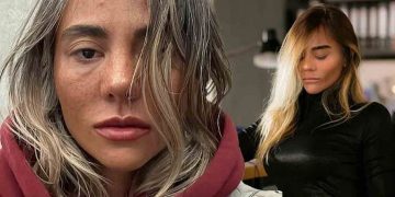 ჩემი დაავადების გამო თავი ხშირად დამიმცირებია და შემირცხვენია.. ეს ძალიან მძიმე დაავადებაა…