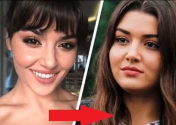 თურქული სერიალების მომხიბვლელი ვარსკვლავები პლასტიკურ ოპერაციებამდე და ახლა.. ზოგიერთს ნამდვილად ვერ იცნობთ (ფოტოები)