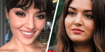 თურქული სერიალების მომხიბვლელი ვარსკვლავები პლასტიკურ ოპერაციებამდე და ახლა.. ზოგიერთს ნამდვილად ვერ იცნობთ (ფოტოები)