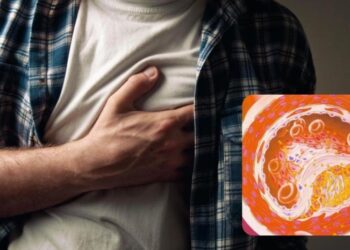 დადგინდა სიმპტომები, რომელიც ინფარქტამდე, ან ინსულტამდე რამდენიმე წლით ადრე ვლინდება – კვლევა