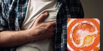 დადგინდა სიმპტომები, რომელიც ინფარქტამდე, ან ინსულტამდე რამდენიმე წლით ადრე ვლინდება – კვლევა