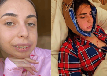 ლილიანას რეაქცია, როდესაც თავისი ახალი სახე პირველად ნახა – ნახეთ ემოციური ვიდეო