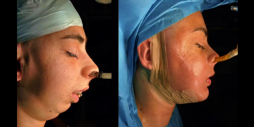 ლილიანას საოცარი ტრანსფორმაცია – ნახეთ, რა ვიდეო ვრცელდება