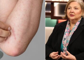 უნდა გადავყაროთ თუ არა მუნით დაინფიცირებული სამოსი? – რას ამბობს დერმატო-ვენეროლოგი თინა ქიტუაშვილი