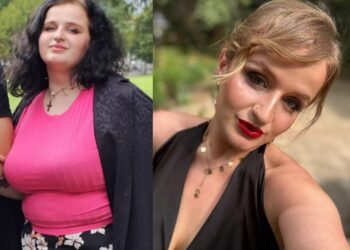 უიშვიათესი ფაქტი: ვინ არის 26 წლის ქართველი გოგო, რომელმაც ბარიატრიული ოპერაცია 3-ჯერ გაიკეთა