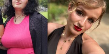 უიშვიათესი ფაქტი: ვინ არის 26 წლის ქართველი გოგო, რომელმაც ბარიატრიული ოპერაცია 3-ჯერ გაიკეთა