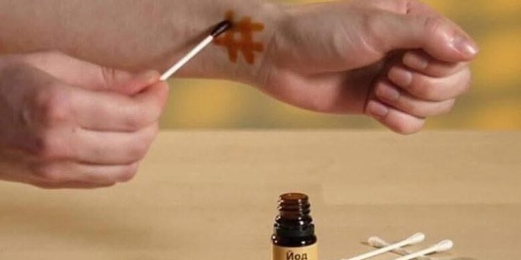 დახატეთ იოდის ბადე და მოიშორეთ 12 დაავადება! იოდის ბადის სასწაულმოქმედი უნარები!