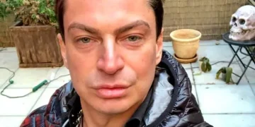 ,,ეს არასდროს მომიყოლია, მაგრამ მოვყვები” – რას ამბობს ზალიკო ბერგერი ნარკოდამოკიდებულებისგან განკურნების შემდეგ?